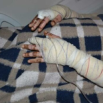 Mulher diz que jogou água fervendo no marido para se defender de agressões em Campo Grande