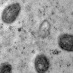 OMS declara fim da emergência em saúde por mpox