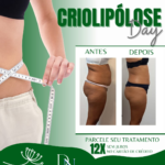Dia primeiro de julho é dia de Criolipólose na Spazen