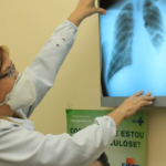 Brasil instala comitê interministerial para eliminação da tuberculose 