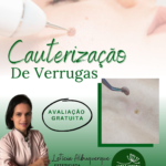 Livre-se de verrugas indesejadas na Spazen