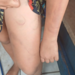 Homem é preso por agredir e torturar enteada autista de 11 anos em MS