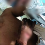 Rapaz de 22 anos tem dedos decepados durante briga de facão em festa