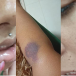 ‘Medo dela ser a próxima’, diz familiar de mulher agredida pelo ex na 4ª invasão a domicílio