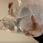 Acidentes com escorpião somam mais de 202 mil notificações em 2023