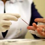 Brasil registra menor mortalidade por aids da série histórica