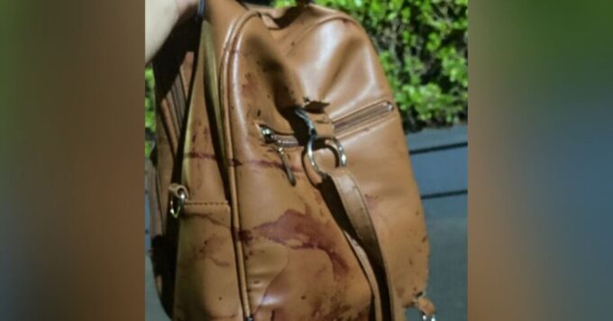 Mulher é esfaqueada mais de 20 vezes pelo ex-namorado em Campo Grande