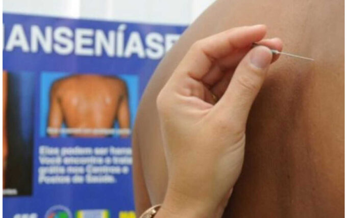 Janeiro Roxo é campanha na luta contra a hanseniase