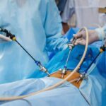 SES amplia acesso à cirurgia bariátrica em MS com triagem criteriosa e novas referências