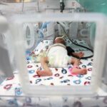 Taxa de nascimentos prematuros do Brasil está acima da média global