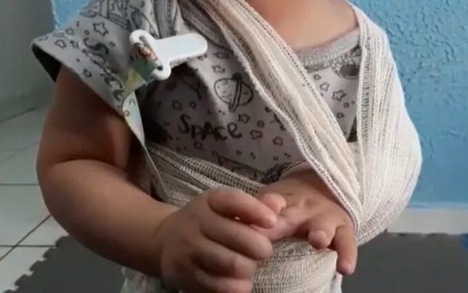 Bebê dá entrada no hospital com braço quebrado e mãe confessa agressão em Sidrolândia