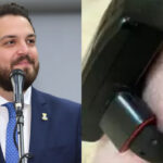 Apesar de ferida na perna, juíza prorroga por mais 180 dias uso de tornozeleira por Claudinho