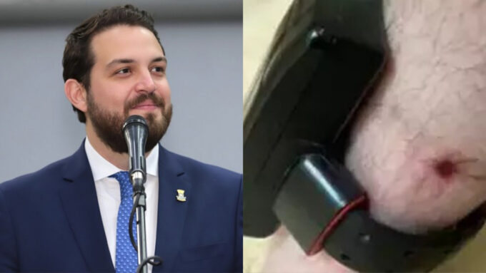 Apesar de ferida na perna, juíza prorroga por mais 180 dias uso de tornozeleira por Claudinho