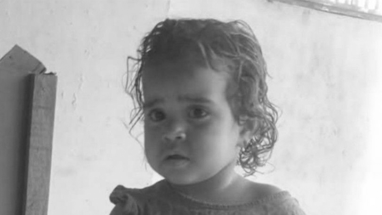 Morre criança que teve 90% do corpo queimado após chapa de bife explodir, em Sidrolândia