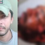 Homem atacado com água fervente em Anastácio vivia relacionamento abusivo, diz família