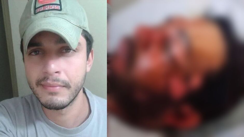 Homem atacado com água fervente em Anastácio vivia relacionamento abusivo, diz família