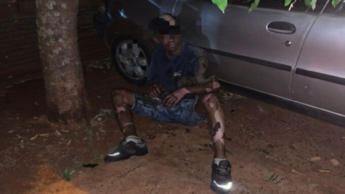 Homem sofre queimaduras enquanto furtava fios em Dourados