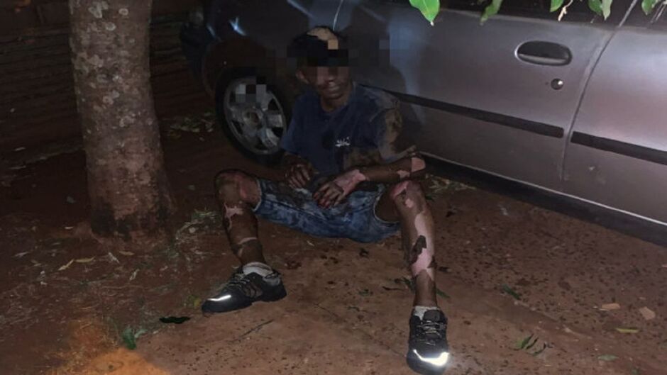 Homem sofre queimaduras enquanto furtava fios em Dourados