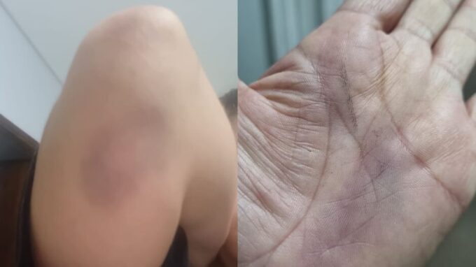 Espancada e ameaçada de morte, mulher pede ajuda para não ser a próxima vítima (vídeo)