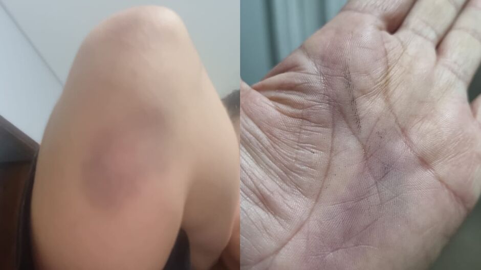 Espancada e ameaçada de morte, mulher pede ajuda para não ser a próxima vítima (vídeo)