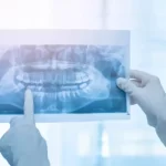 Dez municípios de MS devem ter raio-X panorâmico odontológico