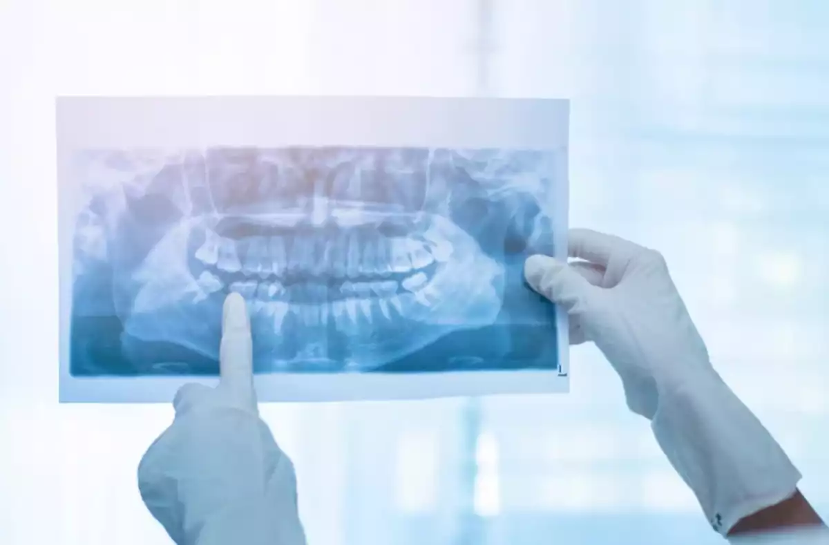 Dez municípios de MS devem ter raio-X panorâmico odontológico