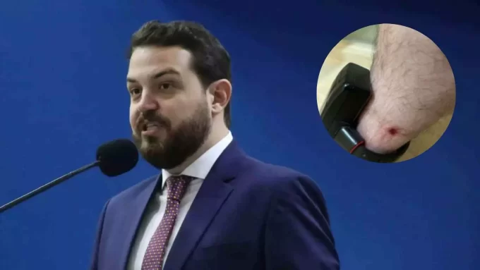 Após sugerir prisão de Claudinho Serra por violar tornozeleira, Agepen volta atrás e ‘culpa’ GPS