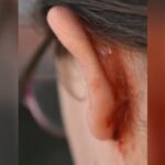 Mulher é agredida com cabeçada ao pegar o filho na casa do ex em Sidrolândia