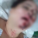 Mulher é espancada por três homens após festa em Ponta Porã