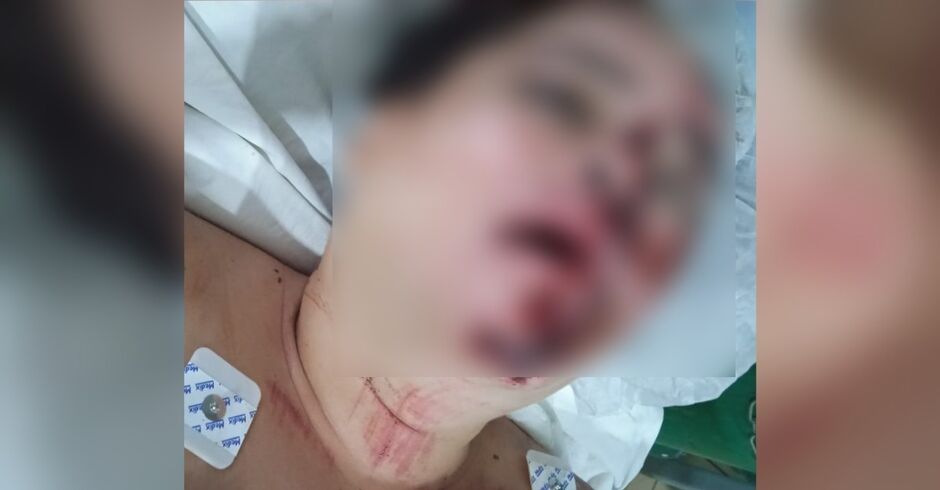 Mulher é espancada por três homens após festa em Ponta Porã