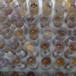 Casos de malária no Brasil caem 26% no primeiro trimestre de 2025