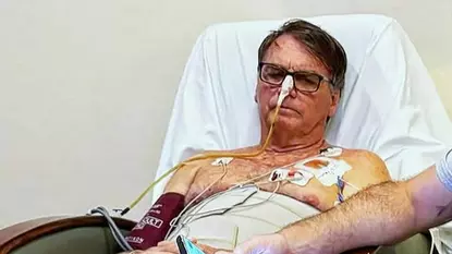 Bolsonaro permanece na UTI e tem melhora em exames laboratoriais