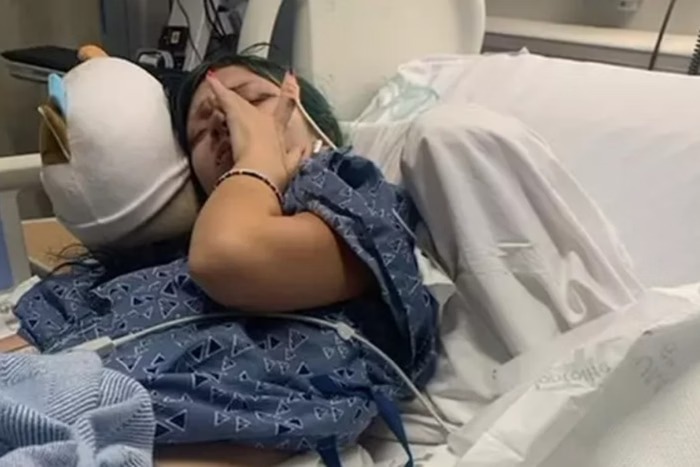 Usuária de vape de 15 anos tem 1 litro de líquido drenado do pulmão