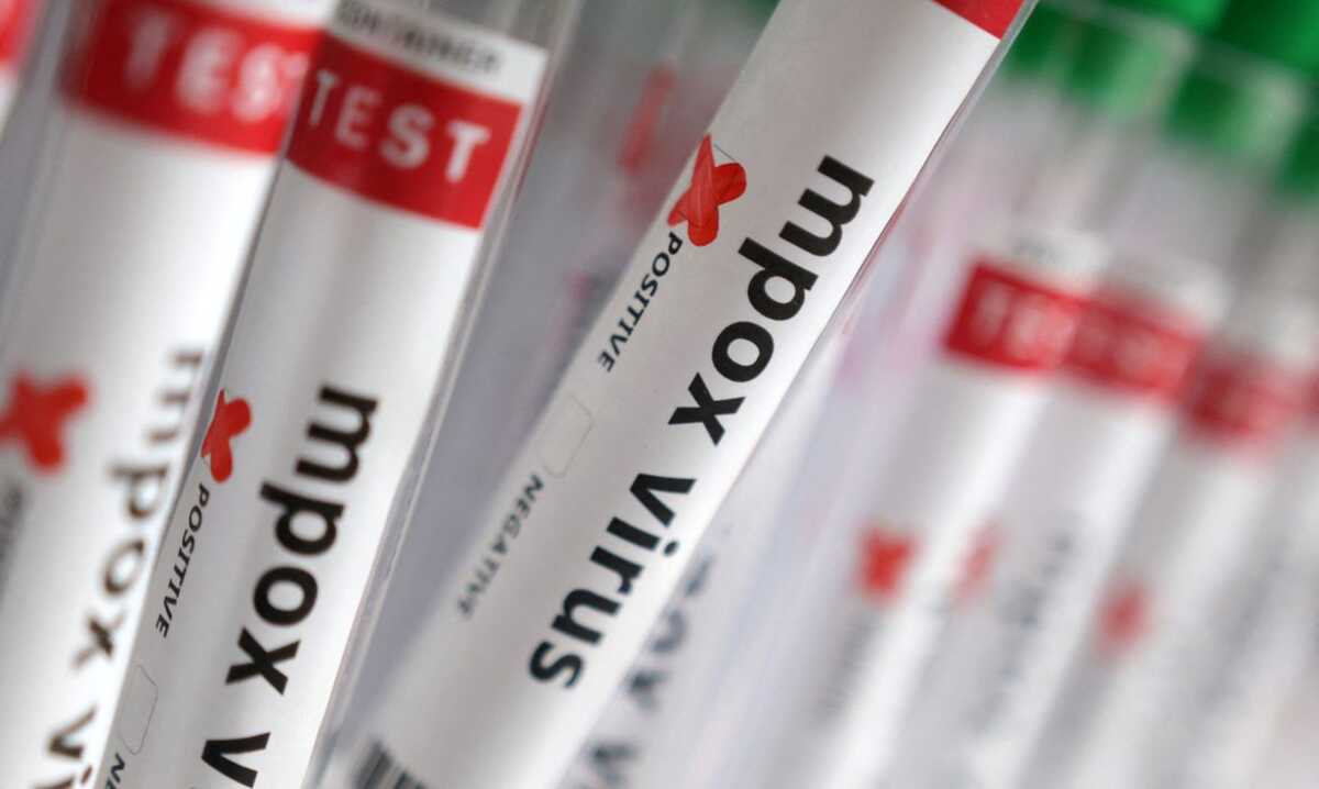 Região Norte do Brasil registra casos de mpox