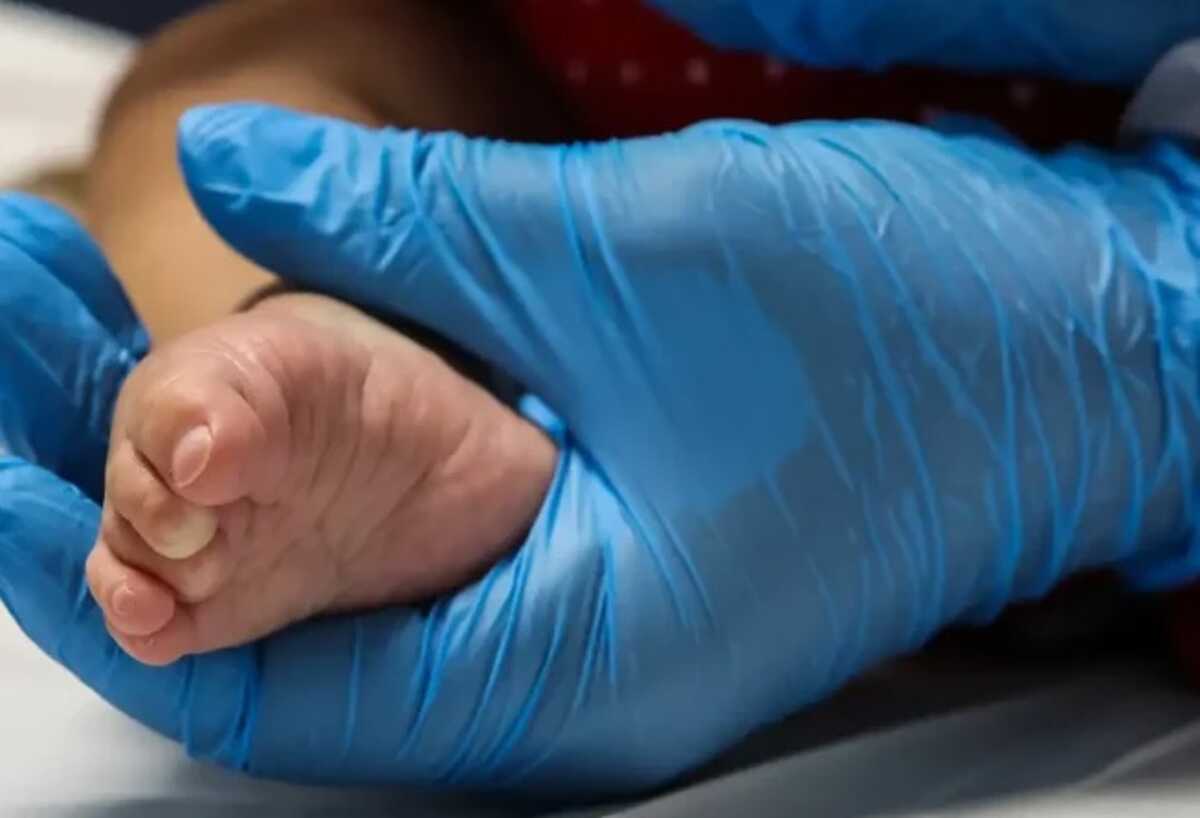 MS amplia teste do pezinho gratuito pelo SUS