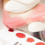 Saúde de Sidrolândia reforça importância da realização do “teste do pezinho”