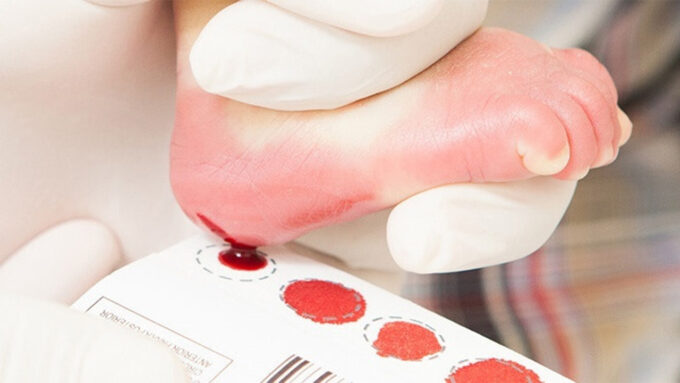 Saúde de Sidrolândia reforça importância da realização do “teste do pezinho”