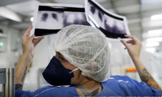 Câncer de pulmão em não fumantes preocupa especialistas