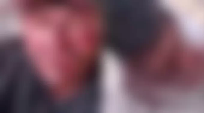 VÍDEO: idosos em situação de rua são espancados em praça; um está em estado grave