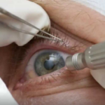 Falta de consultas regulares aumenta chance de doenças graves na visão