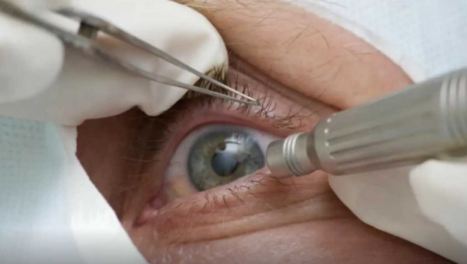 Falta de consultas regulares aumenta chance de doenças graves na visão