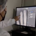 Novos aparelhos de raio-x ampliam em mais de 600 exames mensais em MS