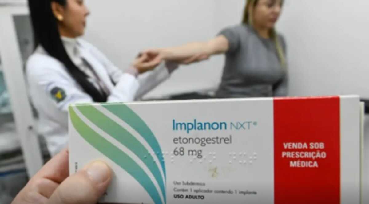 Implante contraceptivo deve ser ofertado por planos a partir de hoje