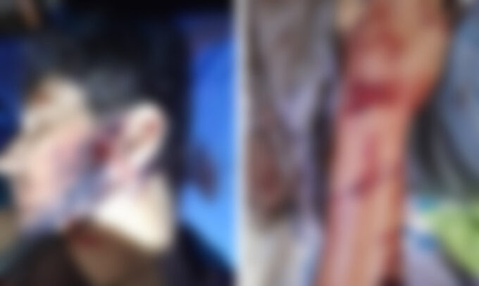 Peão estava sozinho quando foi atacado por onça em fazenda do Pantanal, diz família