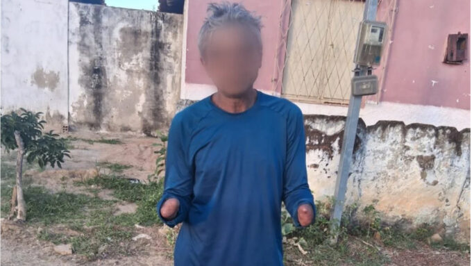 Homem que teve mãos decepadas após furto é preso pela terceira vez pelo mesmo crime