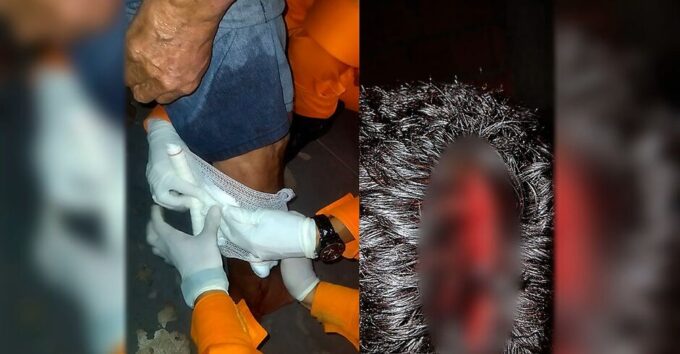 Idoso é atacado por Pitbull e sofre ferimentos graves na cabeça e perna