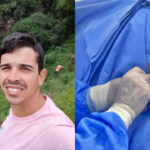 Morador de Sidrolândia paraplégico realiza cirurgia com polilaminina e pode voltar a andar