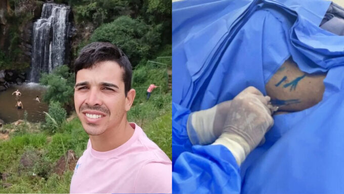 Morador de Sidrolândia paraplégico realiza cirurgia com polilaminina e pode voltar a andar