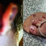 Suspeito de estuprar bebê provocou aborto na mãe da criança; menina está em estado grave