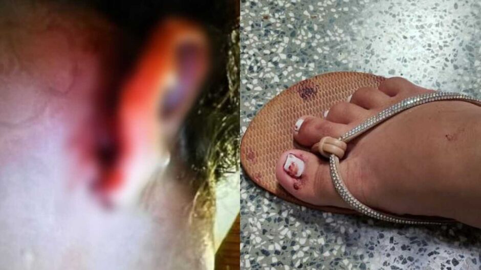 Suspeito de estuprar bebê provocou aborto na mãe da criança; menina está em estado grave